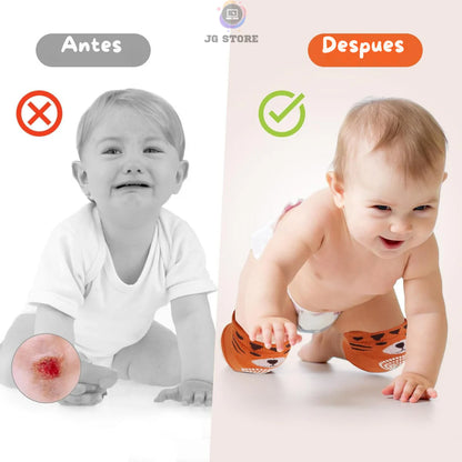 BabyKnee™ Kit x3 Rodilleras Antideslizantes Para Bebé